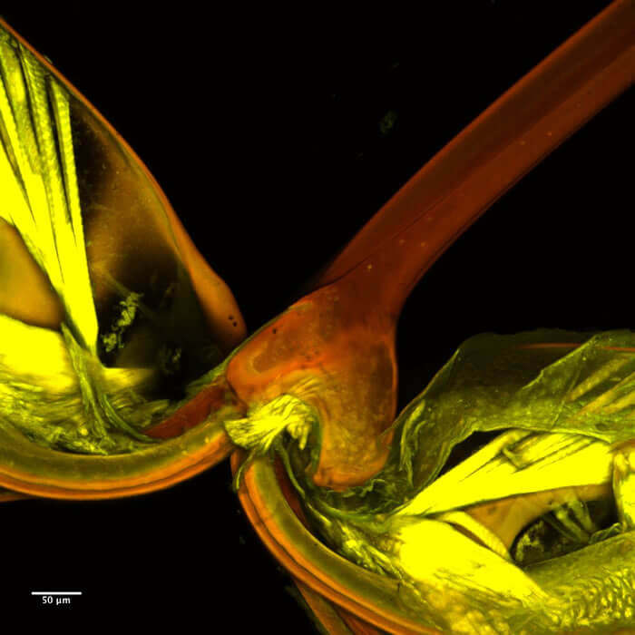 Acaenitinae Micrograph