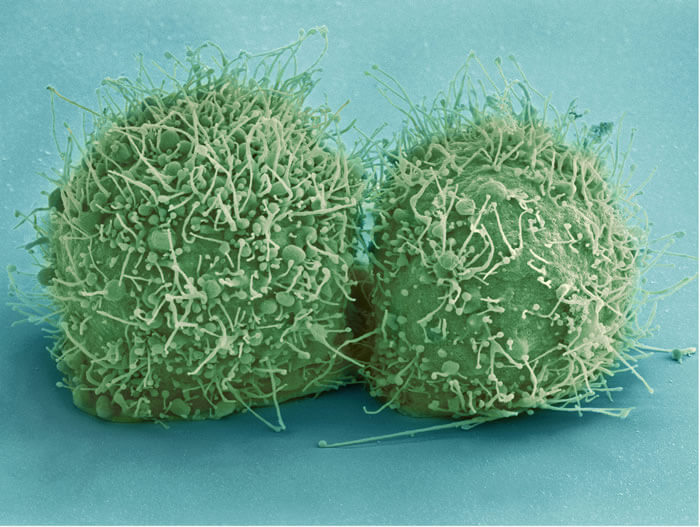 Micrograph Of Just-Divided HeLa Cells