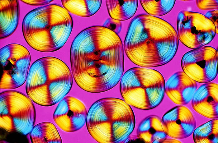 Bladder Sand, Polarizing Light Micrograph