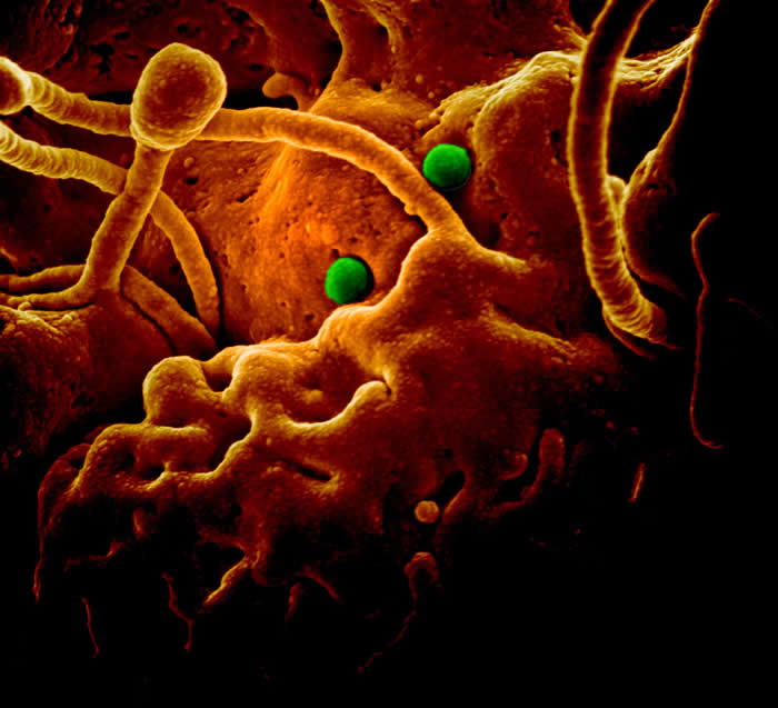 MERS Coronavirus Particles