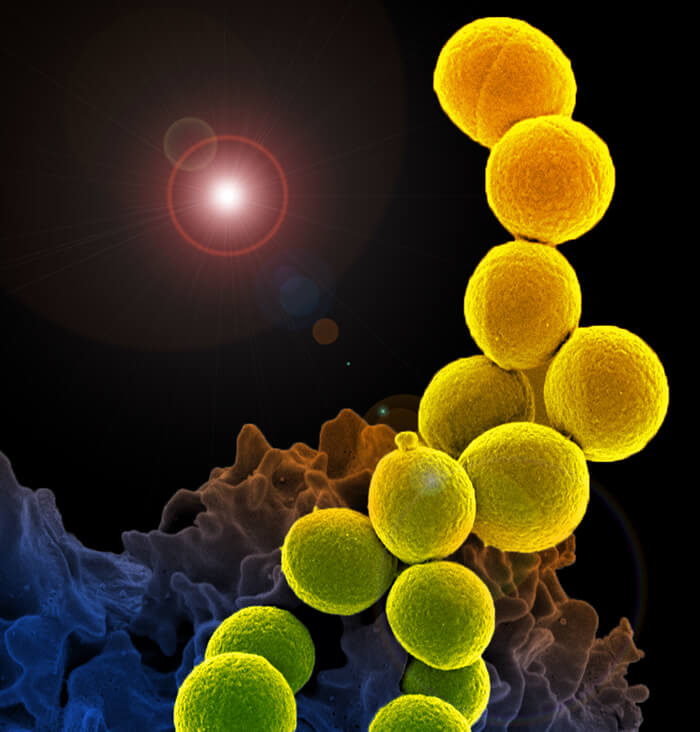 Methicillin-Resistant Staphylococcus Aureus