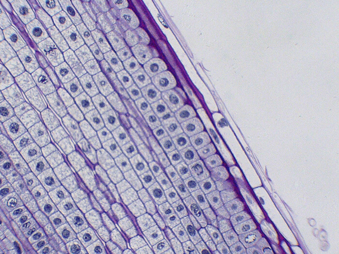 Onion Mitosis