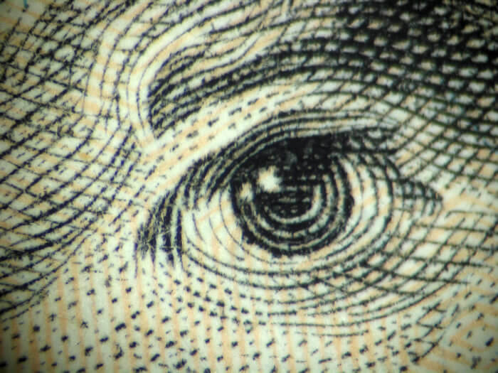 Mr. Jackson’s Right Eye